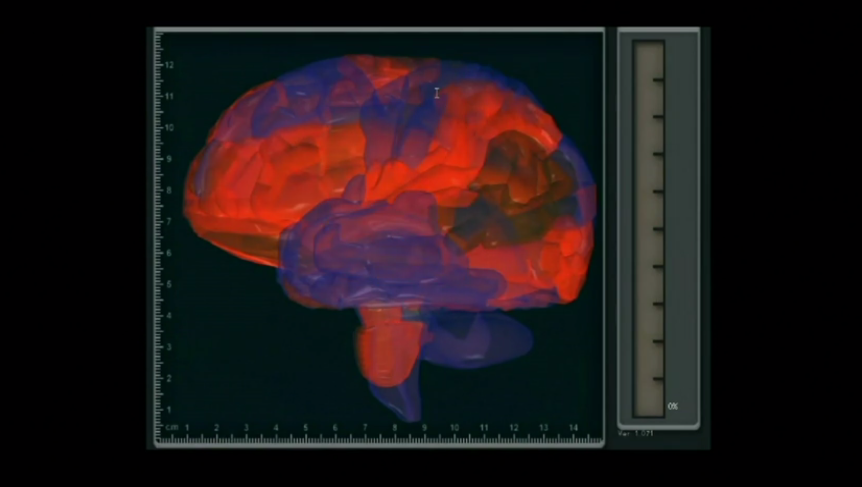 Кристофер Дешарм – Взгляните в мозг в реальном времени - BrainhackBrainhack